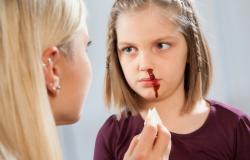 Почему у ребенка из носа идет кровь: причины и лечение носового кровотечения в домашних условиях
